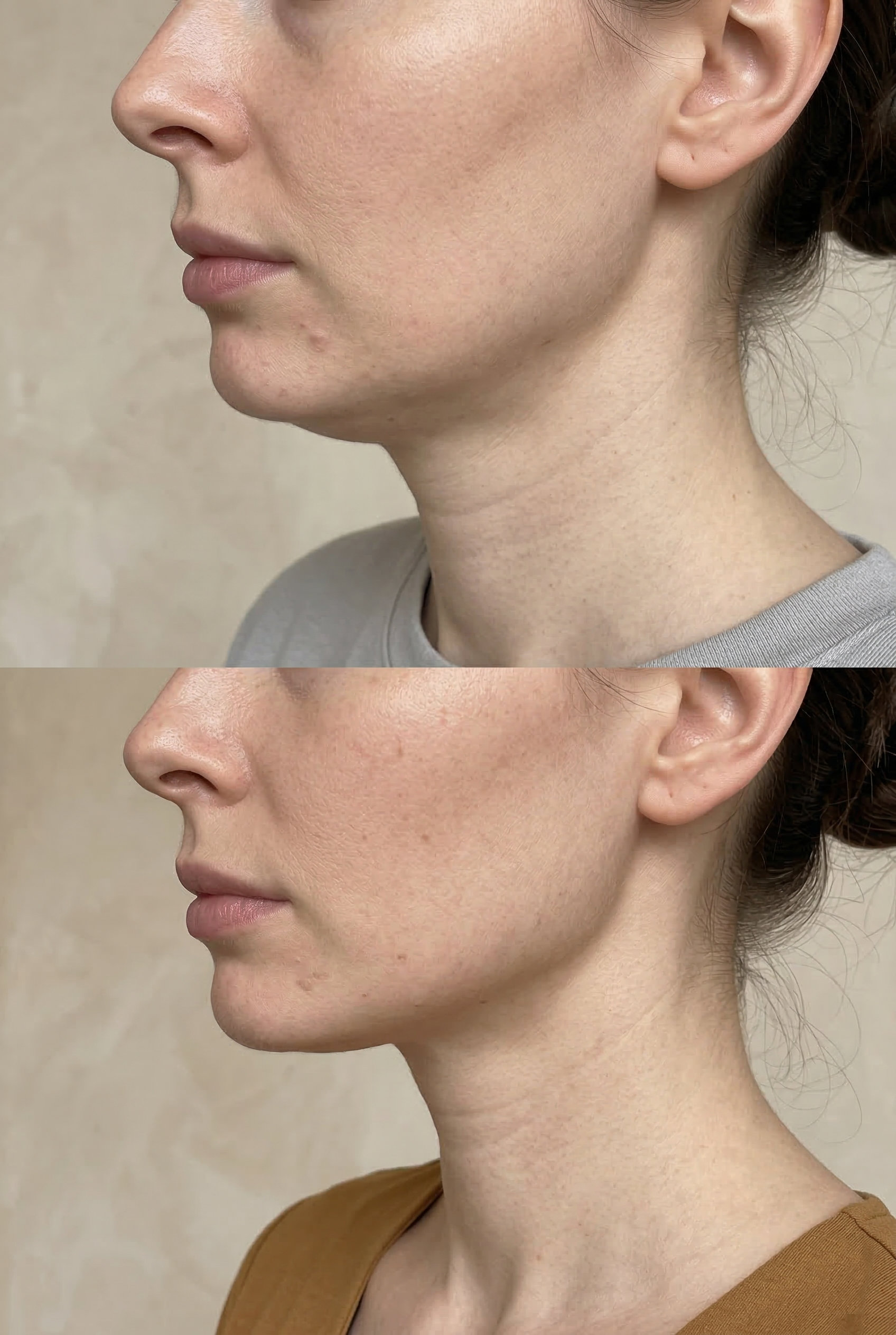 vital-aesthetic-barcelona-caso-2