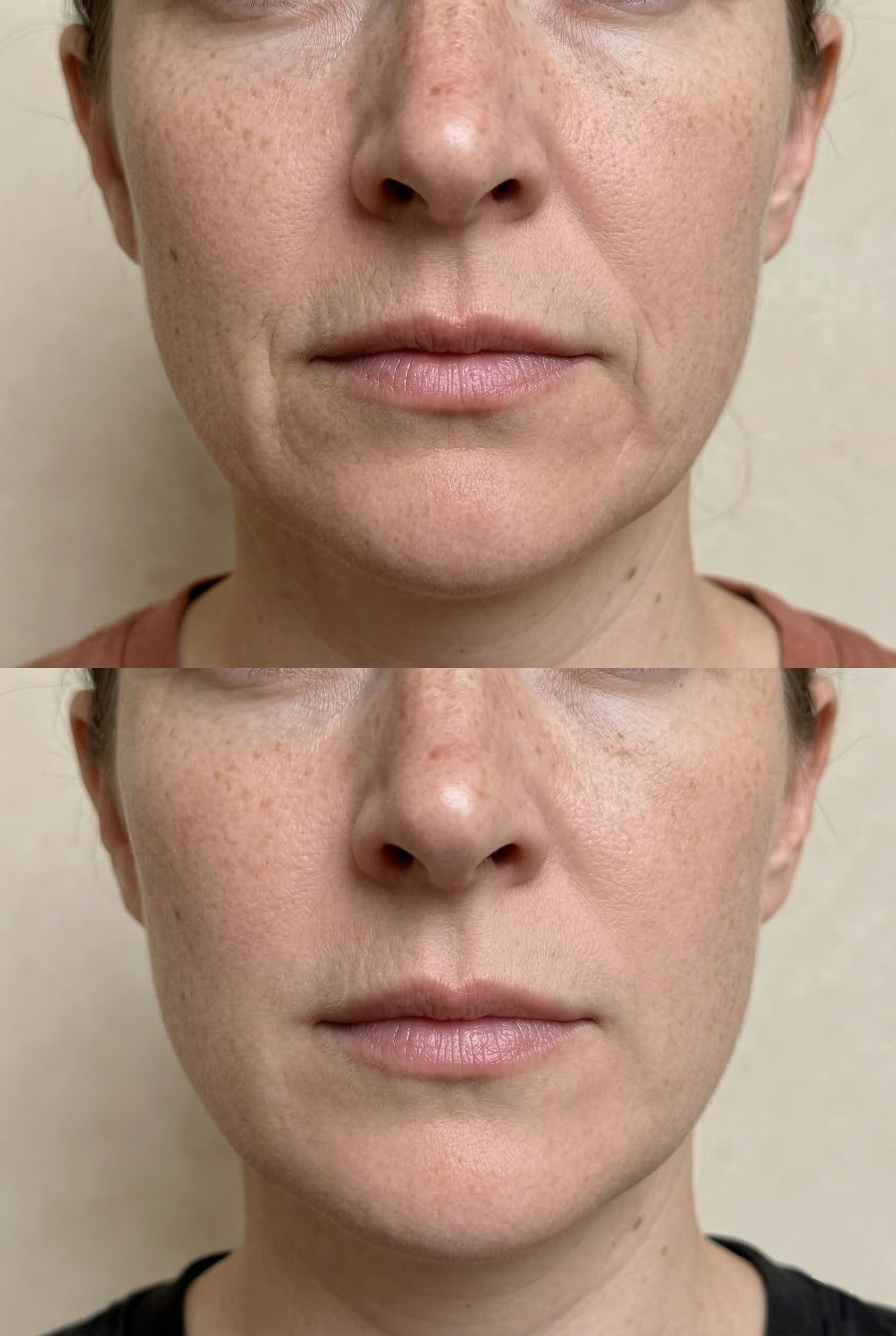 vital-aesthetic-barcelona-caso-3