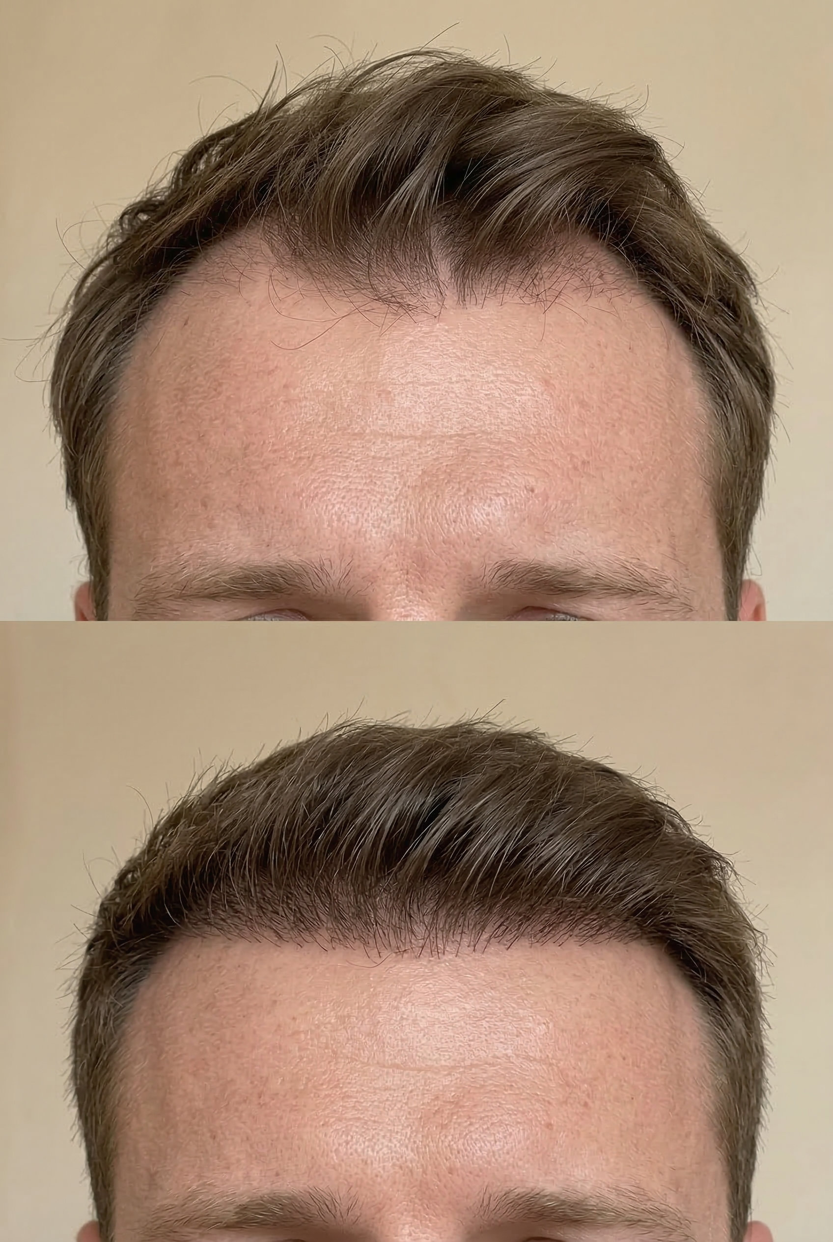 vital-hair-barcelona-caso-1