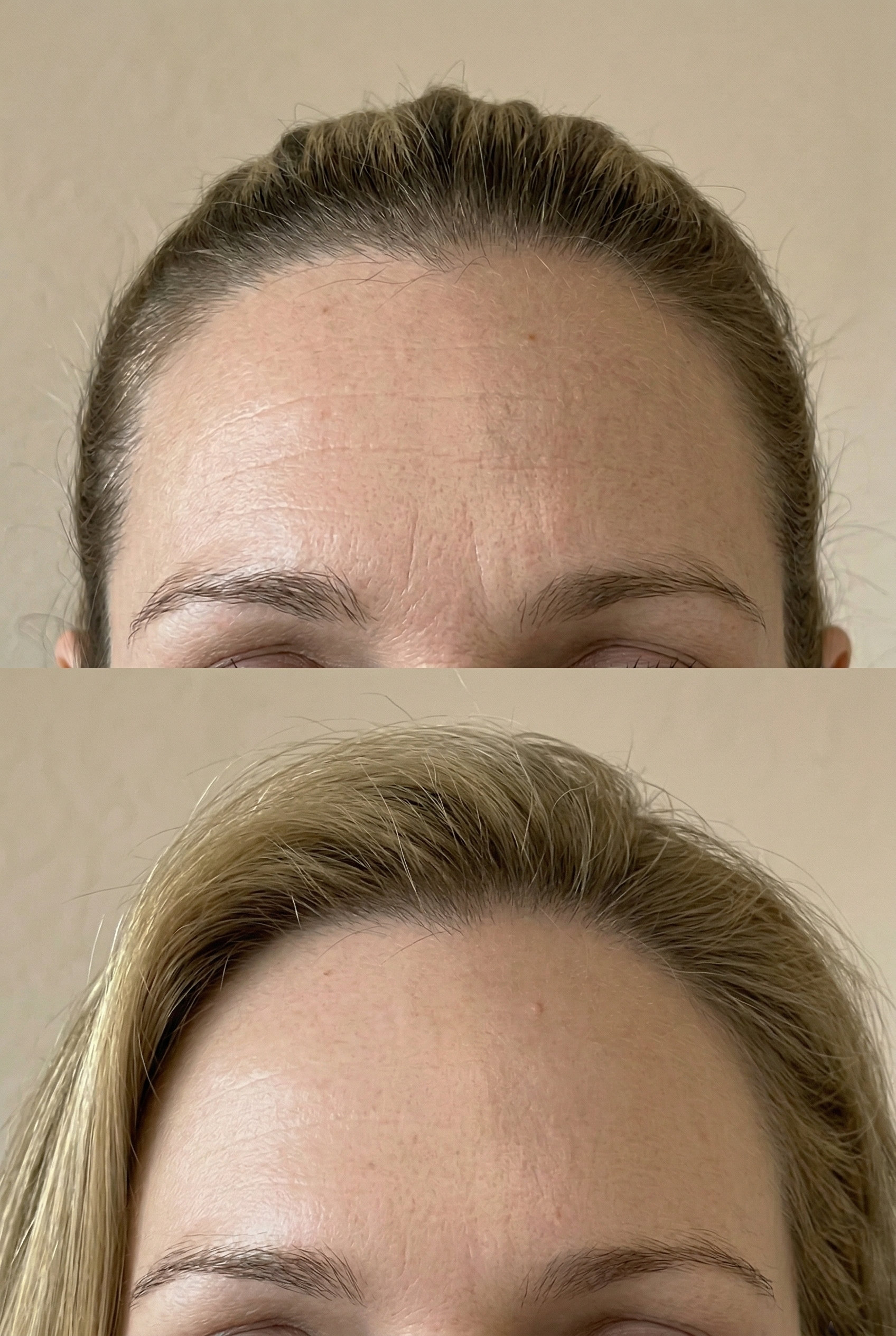 vital-aesthetic-barcelona-caso-1